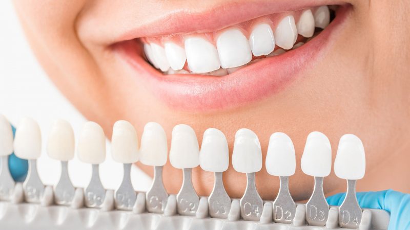 Ways That Dental Implants Work